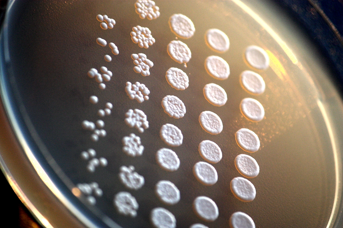 Screening at this scale is the real work. Twenty-nine degrading strains came out of millions.